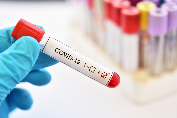 Reporting Work-Related COVID-19 Diagnoses to OSHA